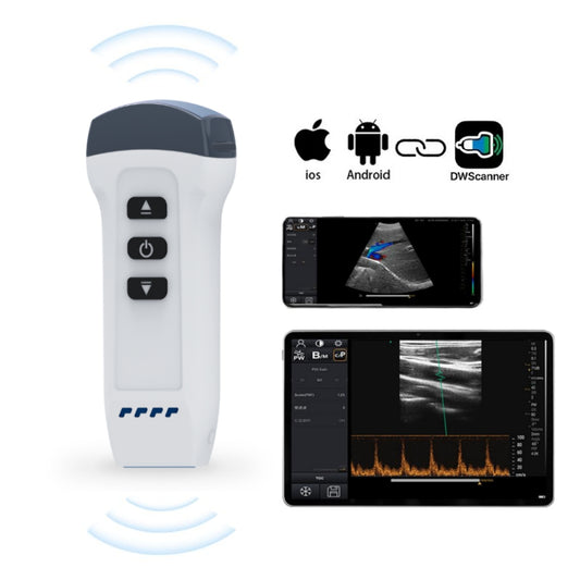 Wireless Veterinary Color Doppler Ultrasound
