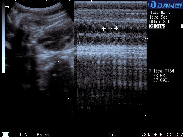 goat fetus heart rate