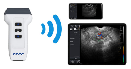 Wireless Veterinary Ultrasound - DWanimal