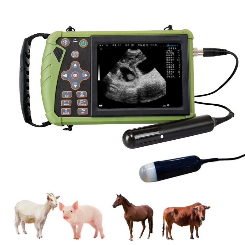 Portable Ultrasound S0 with Mechanical Rectal Probe