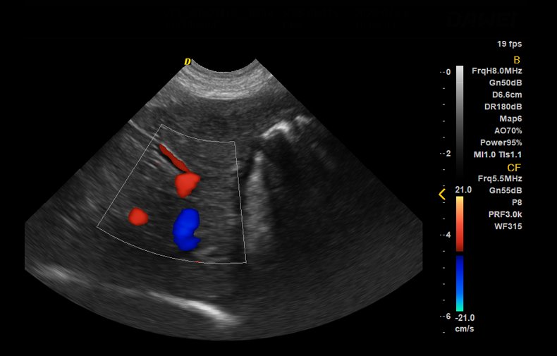 DWanimal F3 - VET Veterinary Color Doppler Ultrasound - DWanimal